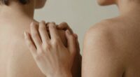 discussing skin health intimacy